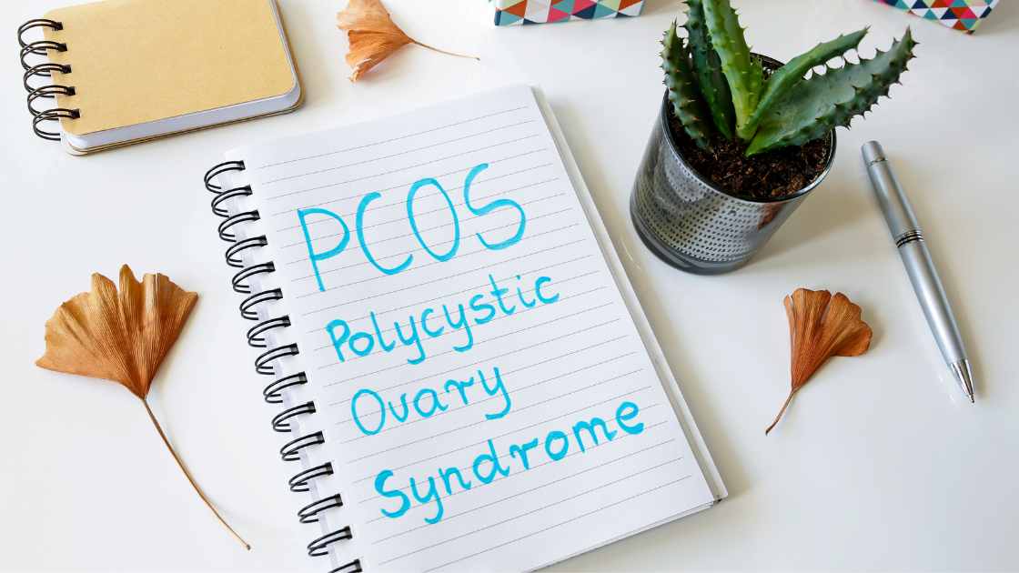 pcos and physiotherapy